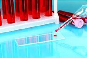 Emoscania del sangue cadute per i parassiti