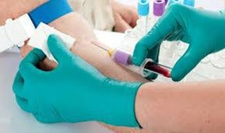 Recinzione del sangue dalla vena del gomito
