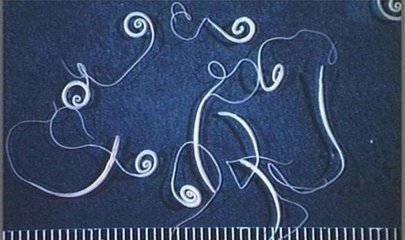 tricocefali dal corpo umano