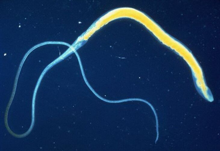 Il tricocefalo è un parassita intestinale comune.