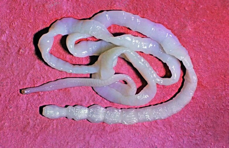 La tenia bovina è un comune elminto intestinale.