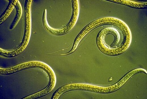 Vermi nematodi parassiti che vivono nell'intestino tenue umano