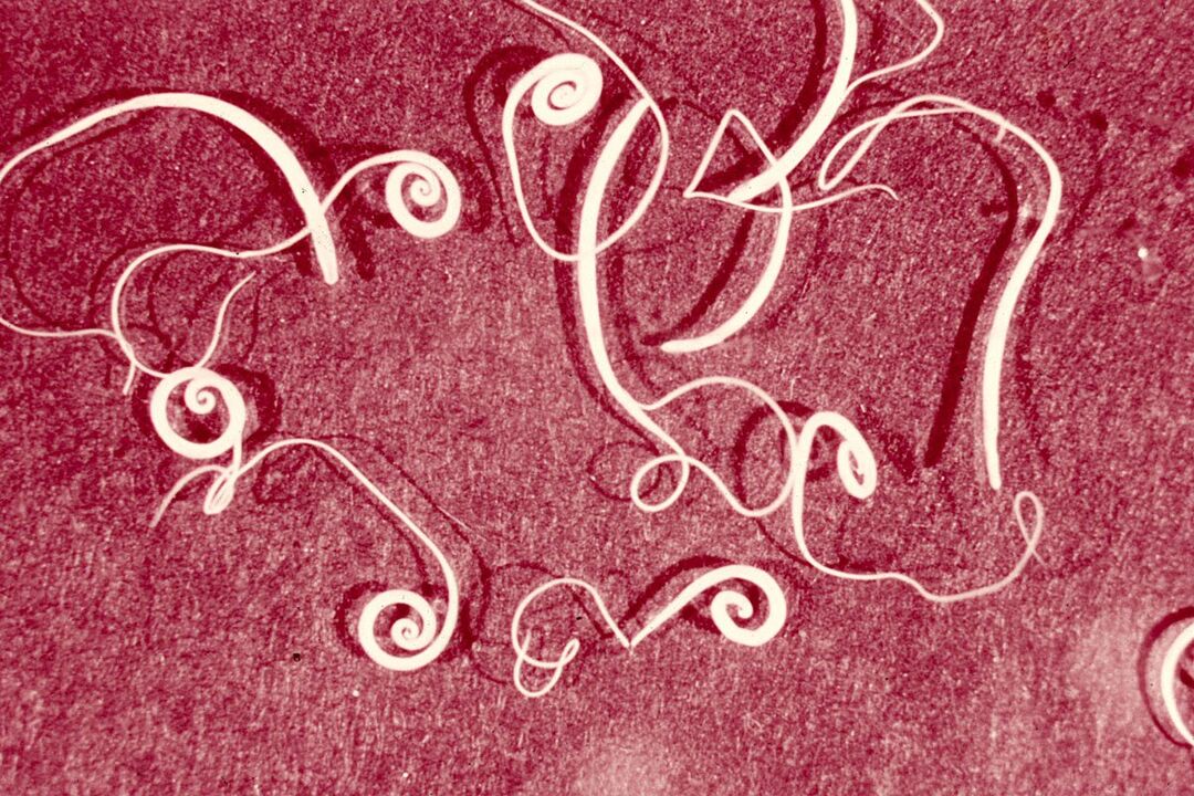 vermi trichinella umani