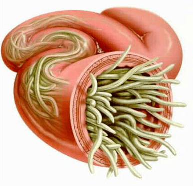 nematodi nell'intestino umano